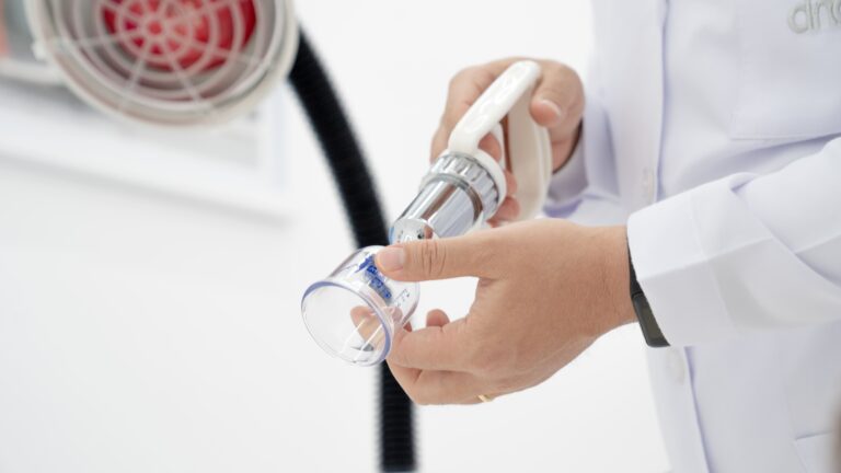 acupuncture suction cups -2 DNA Health Clinics
