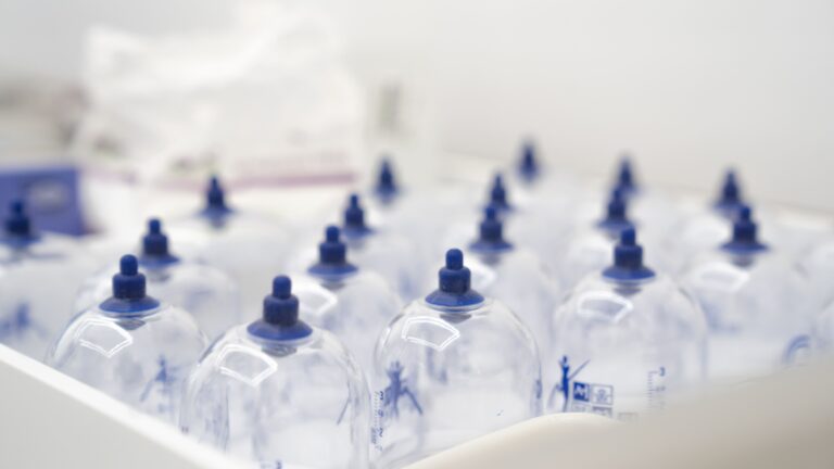 acupuncture suction cups DNA Health Clinics